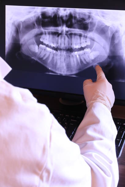Best Emergency Gum Treatment in Tarkio, MO